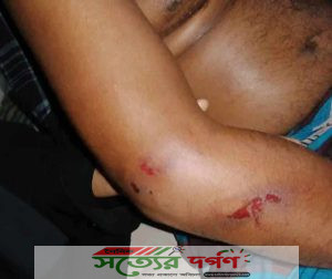 দৌলতপুরে পূর্ব শত্রুতার জেরে সবুজ এর উপর আনোয়ার গং এর হামলা! থানায় অভিযোগ