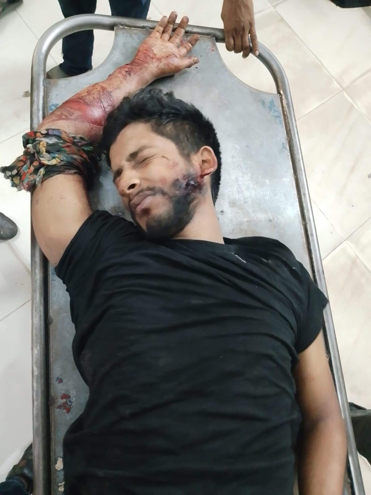 ঝিকরগাছায় সড়ক দুর্ঘটনায় নিহত -১ আহত ১