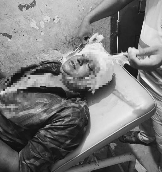 কুষ্টিয়ার ভেড়ামারায় পরকীয়া ও পারিবারিক কলহের জেরে ব্যবসায়ীকে কুপিয়ে জখম, টাকা ছিনতাইয়ের অভিযোগ