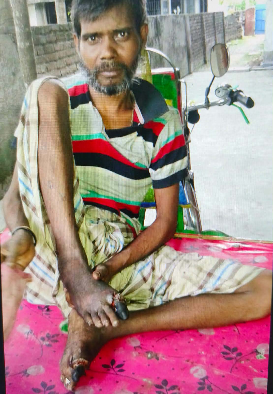 মানবিক ডাক্তারের কারণে বাঁচল প্রাণ, বাঁচল পা, বাঁচল অর্থ, ফিরে পেল পরিবার