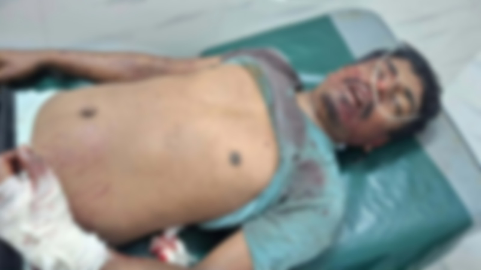 শার্শায় কাভার্ডভ্যান নিয়ন্ত্রণ হারিয়ে গাছের সাথে ধাক্কা হেলপার নিহত